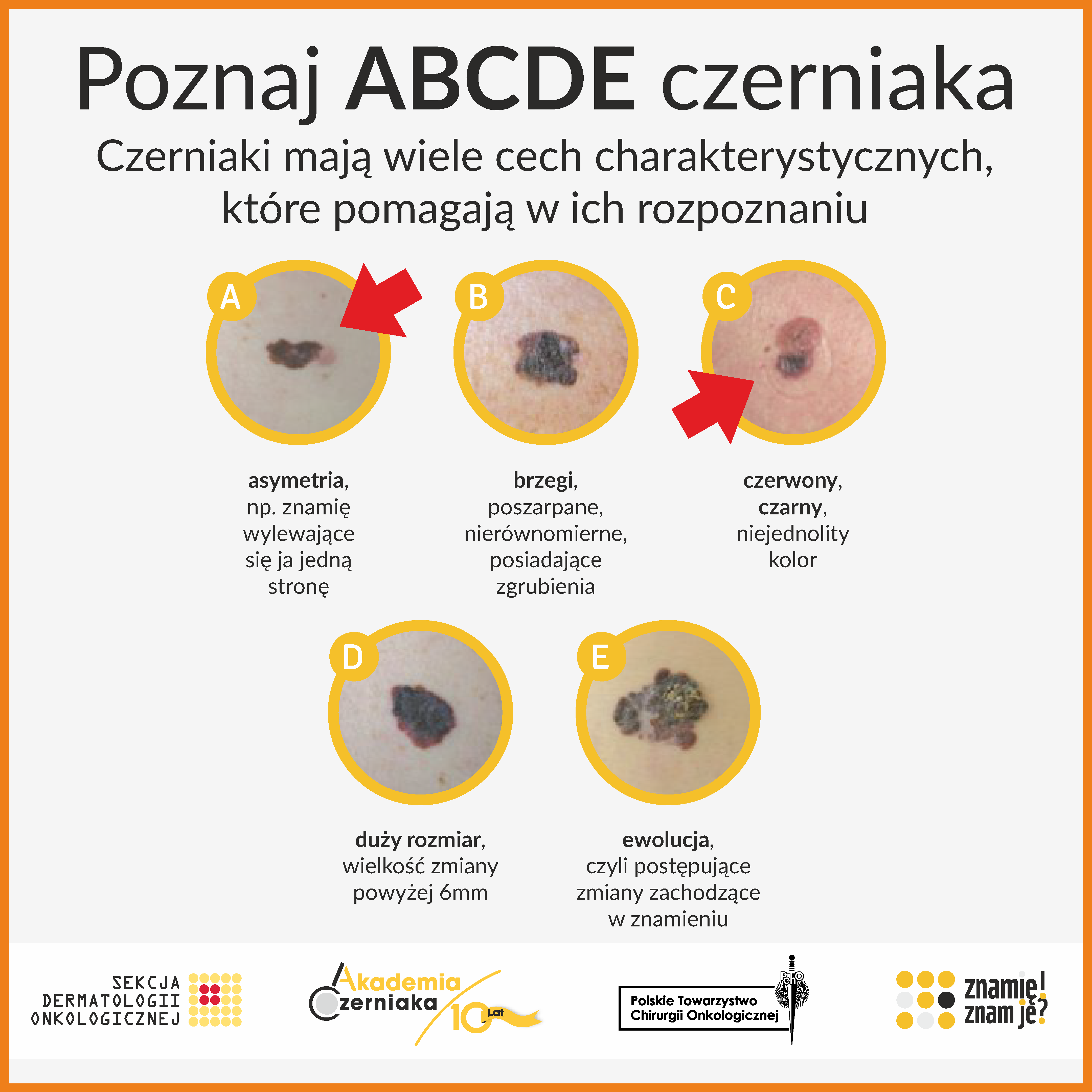 Znamię? Znam je!
